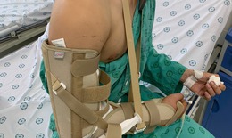 Chơi vật tay, nam thanh ni&#234;n 18 tuổi bị g&#227;y xương c&#225;nh tay