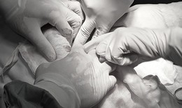 D&#249;ng thuốc nam chữa u nang buồng trứng, người phụ nữ mang khối u nặng 9kg suốt 3 năm