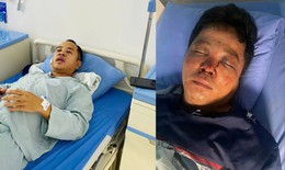Gi&#250;p người bị tai nạn, hai anh em bị h&#224;nh hung d&#227; man đến nguy kịch