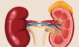 Lời khuy&#234;n hỗ trợ cải thiện suy thận độ 4 hiệu quả