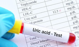 Người bị tăng acid uric cần lưu ý gì để phòng ngừa gout hiệu quả?