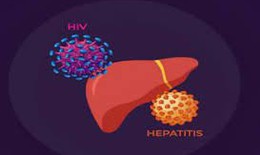 Điều trị đồng nhiễm HIV v&#224; vi&#234;m gan C, gi&#250;p giảm tổn thương gan