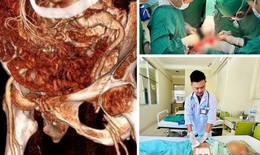 Phẫu thuật cứu sống kịp thời bệnh nh&#226;n 86 tuổi vỡ ph&#236;nh động mạch chủ bụng