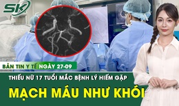 Bản Tin Y Tế 27/9: Mắc hội chứng hiếm, thiếu nữ 17 tuổi c&#243; mạch m&#225;u n&#227;o li ti lan toả như kh&#243;i thuốc