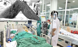 Chỉ từ một vết gai đâm vào đùi, người đàn ông suýt mất mạng