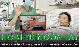 Viêm thuyên tắc mạch máu, loét đầu ngón tay hoại tử vì 30 năm hút thuốc lá