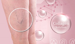 4 lợi ích đảo ngược lão hóa của collagen