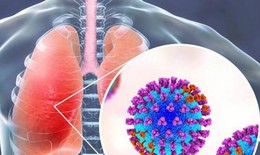 Virus hợp bào hô hấp ở trẻ ủ bệnh bao lâu và cách phòng tránh