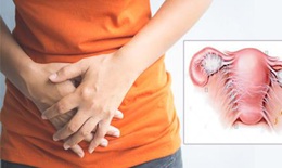 Đang viêm phần phụ có nên sinh hoạt tình dục?