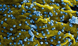 WHO: Ethiopia tuyên bố khống chế được đợt bùng phát virus Marburg