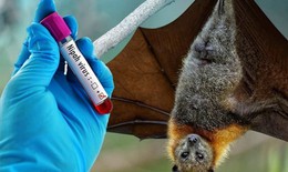 Virus Nipah gây bệnh gì, nguy hiểm như thế nào?