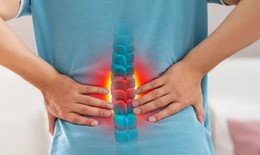 Thói quen dễ gây đau lưng những ngày cận Tết