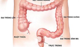 Những lưu ý quan trọng khi nội soi đại tràng, dạ dày bằng gây mê