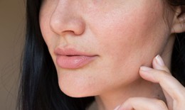 Ngứa ngáy da mặt, khó chịu, cảnh giác với nhiễm nấm