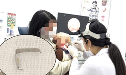 Ghim tất sắc nhọn mắc trong họng bé trai