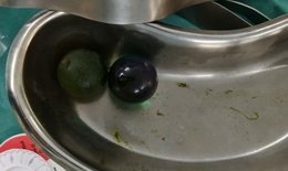 Nhiều trẻ nhỏ bị tắc ruột do nuốt hạt nở đồ chơi