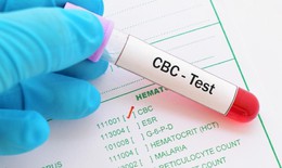 5 xét nghiệm sức khỏe quan trọng với người trên 30 tuổi