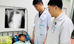 Cứu lá phổi suýt bị hủy hoại do tràn mủ màng phổi phức tạp