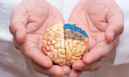 Nguyên nhân phổ biến gây đột quỵ và “thời gian vàng” trong cấp cứu