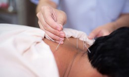 Châm cứu trong y học hiện đại: Giá trị truyền thống, ứng dụng mới