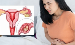 Dấu hiệu mang thai ngoài tử cung cần nhận biết sớm