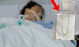 Người phụ nữ 48 tuổi phát hiện sán dây bò dài 70cm dù không có triệu chứng