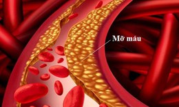 Triglyceride cao gây viêm tụy cấp nguy hiểm đe doạ tính mạng