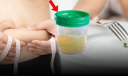 Nhịn ăn giảm cân, người phụ nữ 30 tuổi phát hiện tiểu đường, nước tiểu đầy bọt