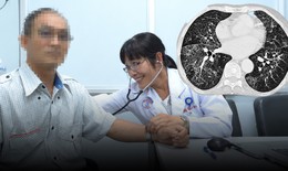 Phế nang phổi người đàn ông ngập chất đạm, phát hiện vi khuẩn hiếm