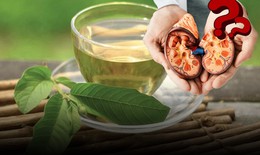 Uống nước lá ổi mỗi ngày có làm hỏng thận như lời đồn trên mạng? 