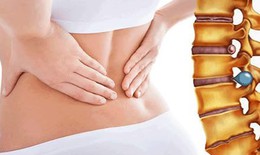 Nguy cơ thoát vị đĩa đệm do ngồi sai cách