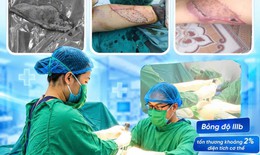 Ghép da cho bệnh nhân bỏng bô xe máy