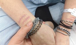 Khi con tự làm đau bản thân: Cha mẹ cần làm gì?