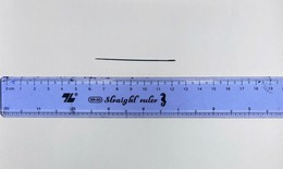 Lấy thành công kim khâu dài 6 cm nằm trong gan người đàn ông 