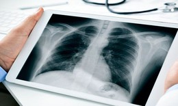 Bộ Y tế đề nghị thanh toán BHYT kỹ thuật điện quang không phụ thuộc vào thời gian chụp chiếu