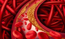 Giảm cholesterol bằng thực dưỡng: Chìa khóa bền vững bảo vệ tim mạch từ bữa ăn hằng ngày