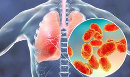 Nguy cơ viêm phổi và viêm phế quản gia tăng trong mùa đông - xuân