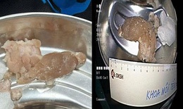 Nuốt vội miếng thịt trong bữa tối, người đàn ông suýt tắc thở