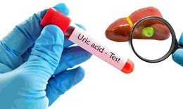 Cách dùng cần tây hỗ trợ giảm axit uric tại nhà: Lợi ích và những điều cần lưu ý