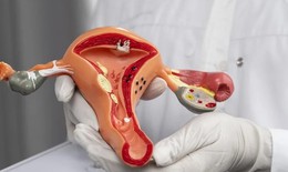 Tắc vòi trứng gây cản trở khả năng thụ thai tự nhiên