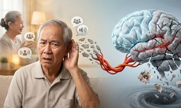 Suy giảm thính lực có thể làm tăng nguy cơ sa sút trí tuệ