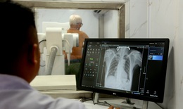 Phát hiện sớm để chặn nguồn lây bệnh lao trong cộng đồng