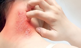 Nguy cơ nhiễm trùng máu có thể xảy ra từ các vết thương nhỏ