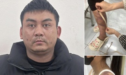 Khởi tố kẻ nhiều lần đánh đập vợ đang mang thai và con gái 13 tuổi