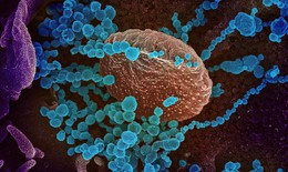 Campuchia giám sát biến thể mới của virus SARS-CoV-2