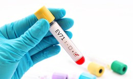 Trẻ mắc tay chân miệng do virus EV71 dễ chuyển nặng: khả năng tồn tại và lây lan của virus là bao lâu?