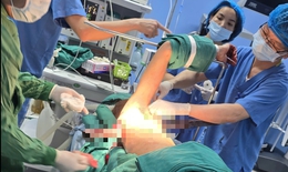 Nạn nhân bị thanh sắt đâm xuyên ngực trên cao tốc Nội Bài - Lào Cai đã được phẫu thuật thành công 
