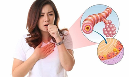 Dùng kháng sinh điều trị viêm phế quản cấp tính: Hiểu đúng để điều trị hiệu quả