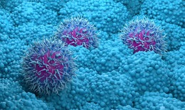 Lộ diện loại thuốc sẽ mở ra hy vọng sống cho người ung thư tụy