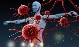 Những bộ phận nào trên cơ thể thường gây ung thư và cách phòng tránh hiệu quả